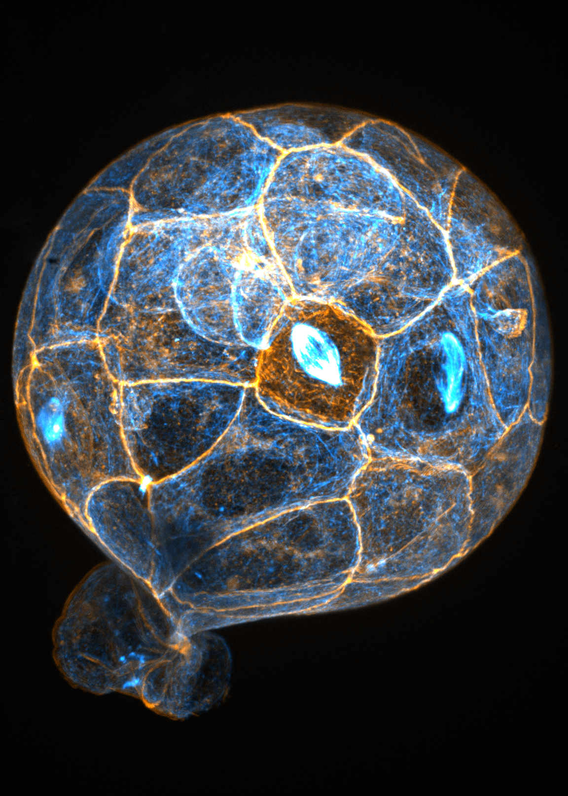 Blastocyst — early embryo development